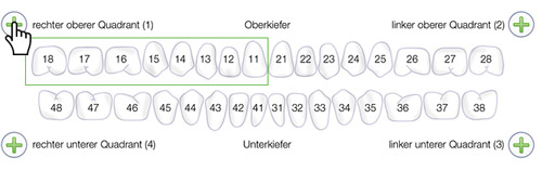 FDI-Schema Erwachsenenzhne