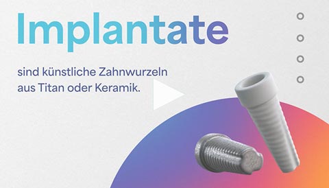 Film Implantate