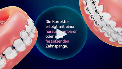 Video Kieferorthopdie