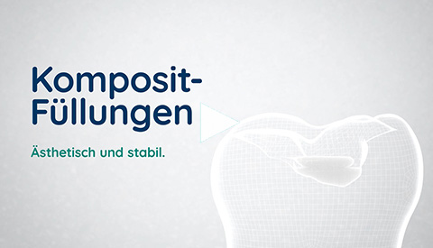 Film Kompositfllungen